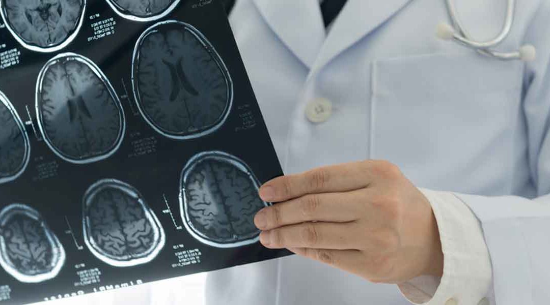 Neurosurgery